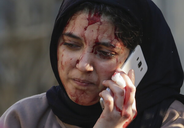  가자 남부의 데이르 알 발라에 대한 이스라엘의 공습에 부상당한 팔레스타인 여성. 개전이후 지금까지 팔레스타인 사망자는 최소 2만2300명이다. 2024. 01. 05 [EPA=연합뉴스]