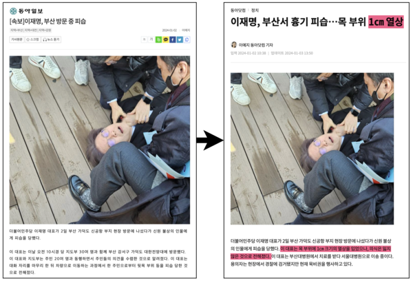 1월 2일 10시 40분에 속보로 올라온 좌측의 동아일보 기사 제목은 어느 틈엔가 우측 ‘이재명, 부산서 흉기 피습 ...목 부위 1cm 열상’으로 수정되었다(기사 출처 : 빅카인즈, 동아닷컴). 
