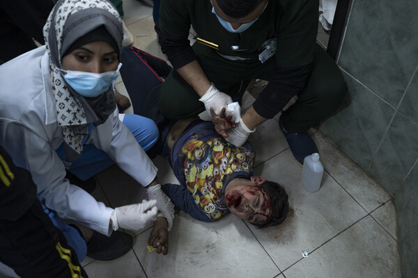 가자에 대한 이스라엘의 폭격으로 부상한 한 팔레스타인 아이를 라파의 알 나자르 병원으로 옮기고 있다. 2024. 02. 24. [AP=연합뉴스]