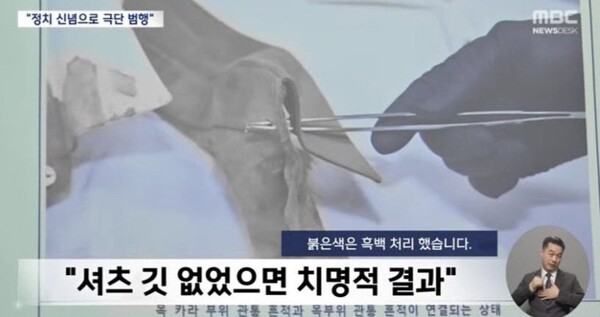 이재명 대표는 그야말로 가까스로 죽을 고비를 넘기고 살아왔다/ MBC 뉴스 화면 갈무리