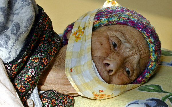 제주4.3사건으로 인한 비극과 고통의 상징인 `무명천 할머니' 진아영(90)씨의 생전 모습. 진 할머니는 경찰이 쏜 총탄에 턱을 잃고 이렇게 천으로 턱을 두른채 55년을 살다가 9일 오전 타계했다. 2004.9.9. (제주=연합뉴스)